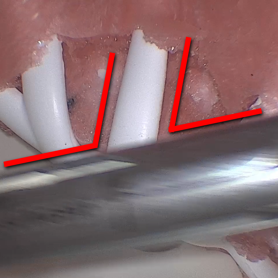 Entrance and Exit Angles